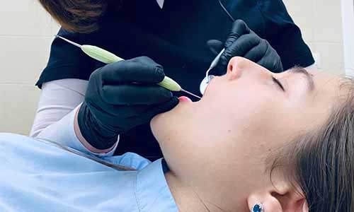 Dental Implant